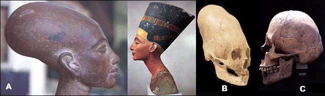 Nefertiti a tvarovan lebky